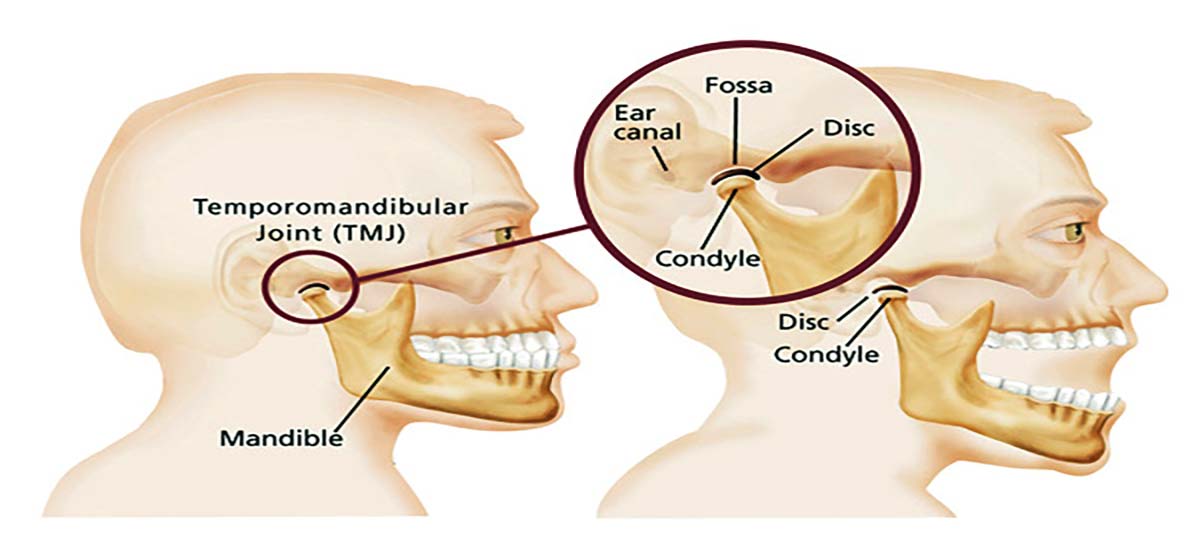 TMJ & TMD Jaw Information