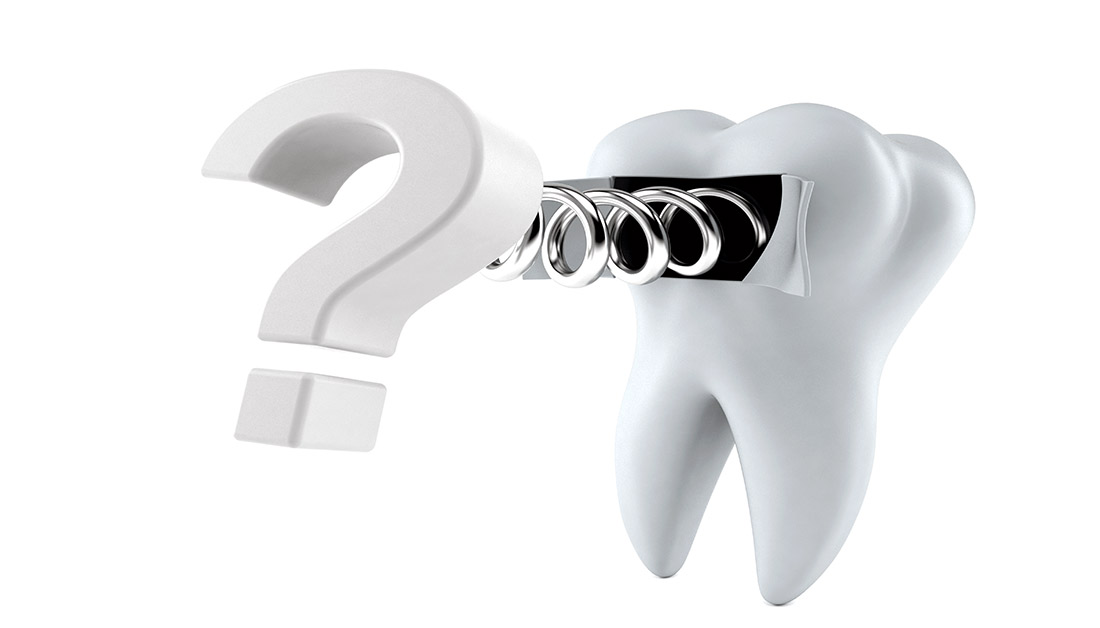 Tooth Pain Questions