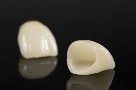 Dental Crown Placement, Dental Crown Information, dentist blog about dental crowns