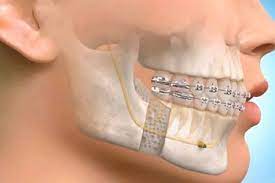 Oral and Maxillofacial Surgery Chat, Oral Surgeon Blog,  Dental Specialty Blogging about Oral Surgeons