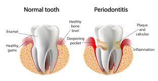 Online Periodontics Discussion, Local Periodontist Chat, Local Periodontists Blog