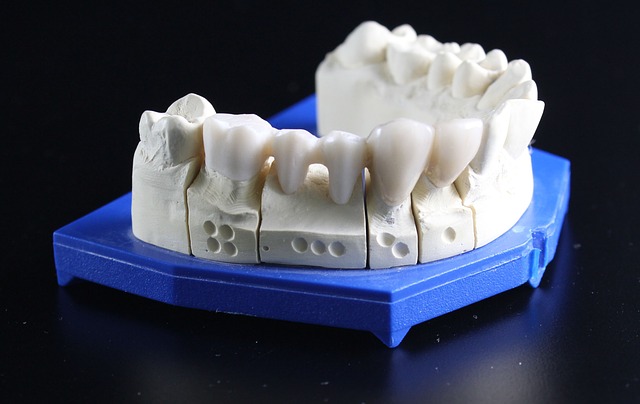 Bruxism - Grinding of Teeth while Sleeping / Dental Blog & Local Dental Chat online